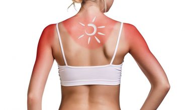 Yaz aylarının zararlı mirası; Güneş lekeleri 1