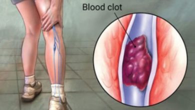 Yürürken bacağınızda ağrı mı hissediyorsunuz? 1