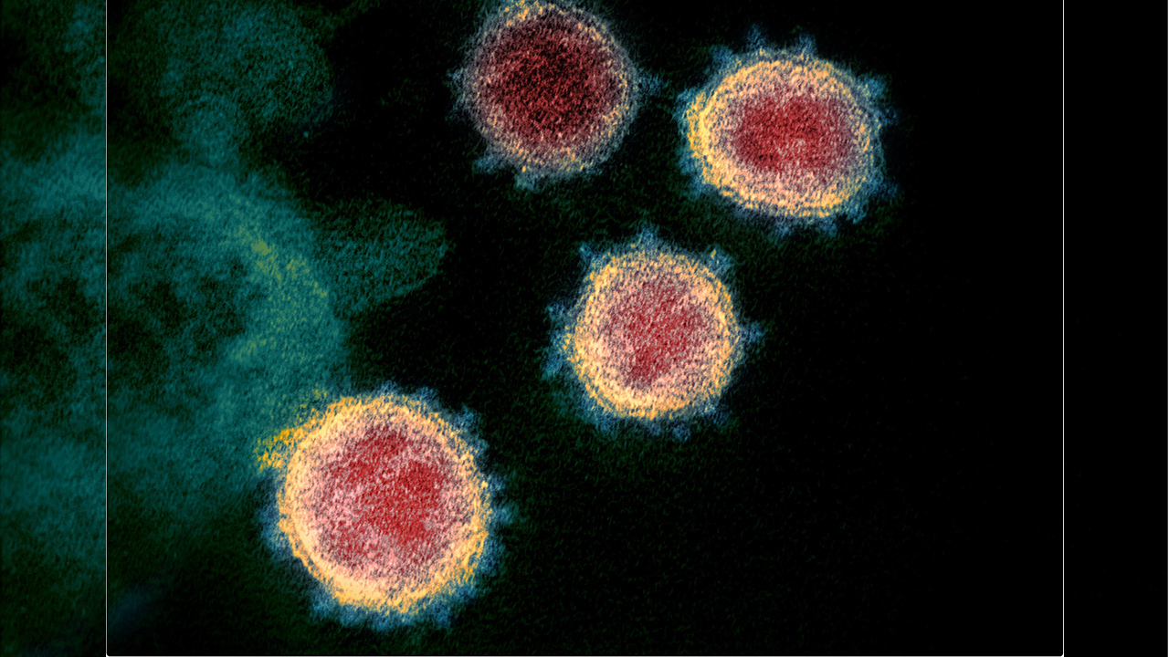 Dünya genelinde Delta Varyantı paniği 6