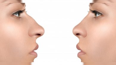 Burun ucu neden düşer ? 3