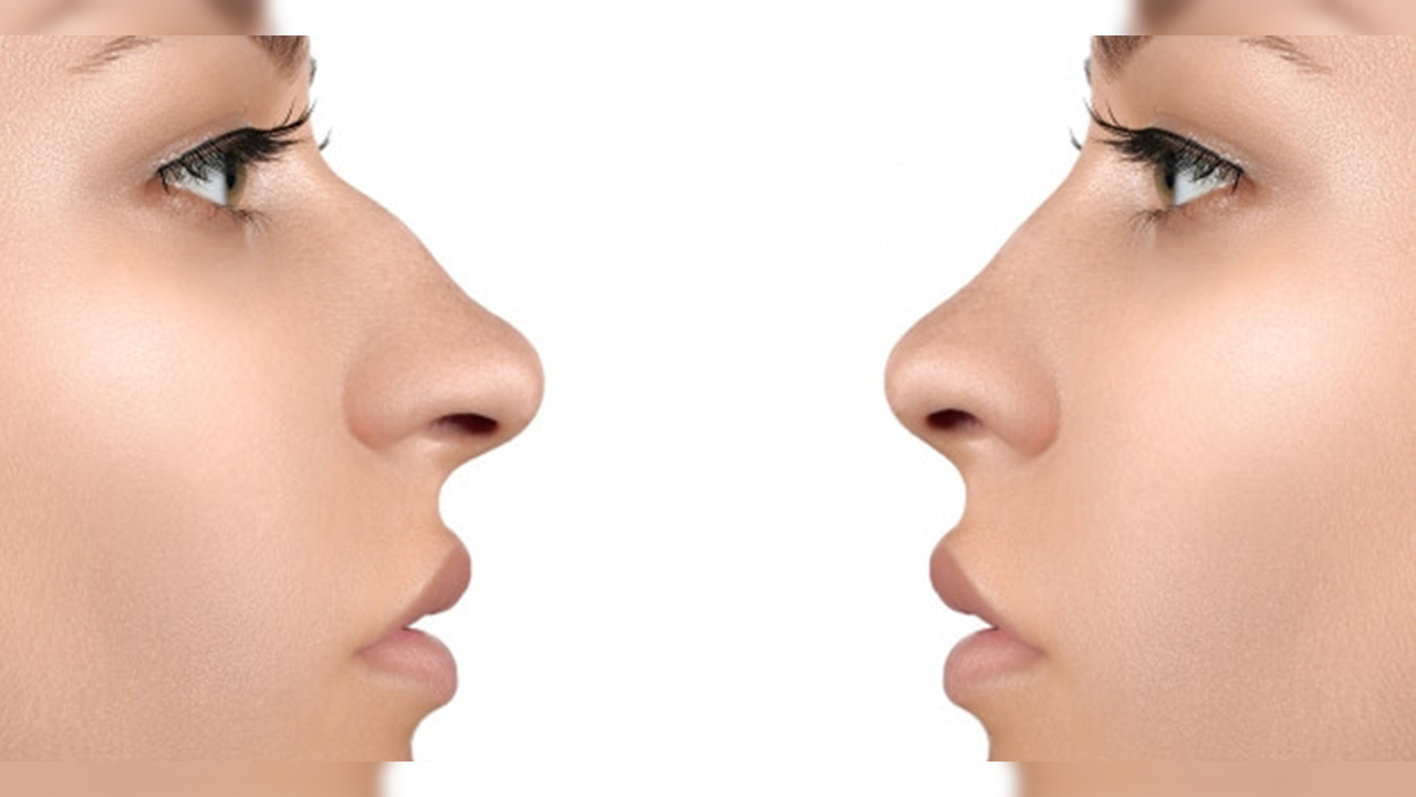 Burun ucu neden düşer ? 7