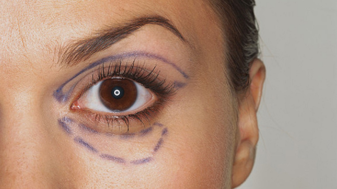 Göz çevresi sorunlarına etkili tedavi ! 7