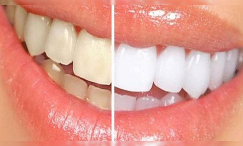 Sağlikli dişlere sahip olmanin 9 yolu 1