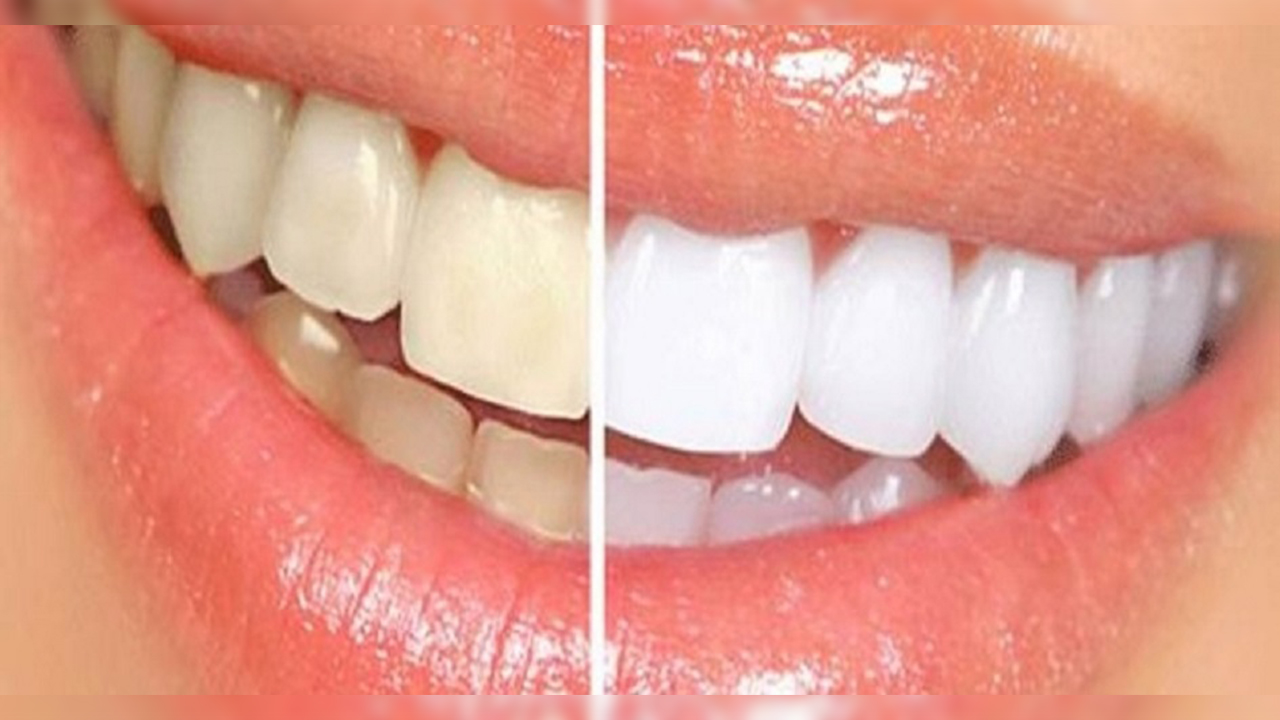 Sağlikli dişlere sahip olmanin 9 yolu 7