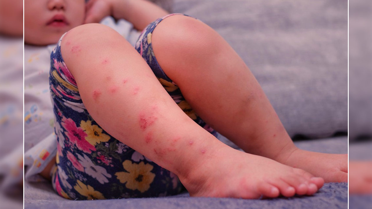 Bu salgından en çok çocuklar etkileniyor 7