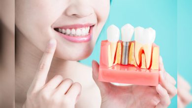 İmplant tedavisinde doğru tercih hekimlerden geçiyor 1