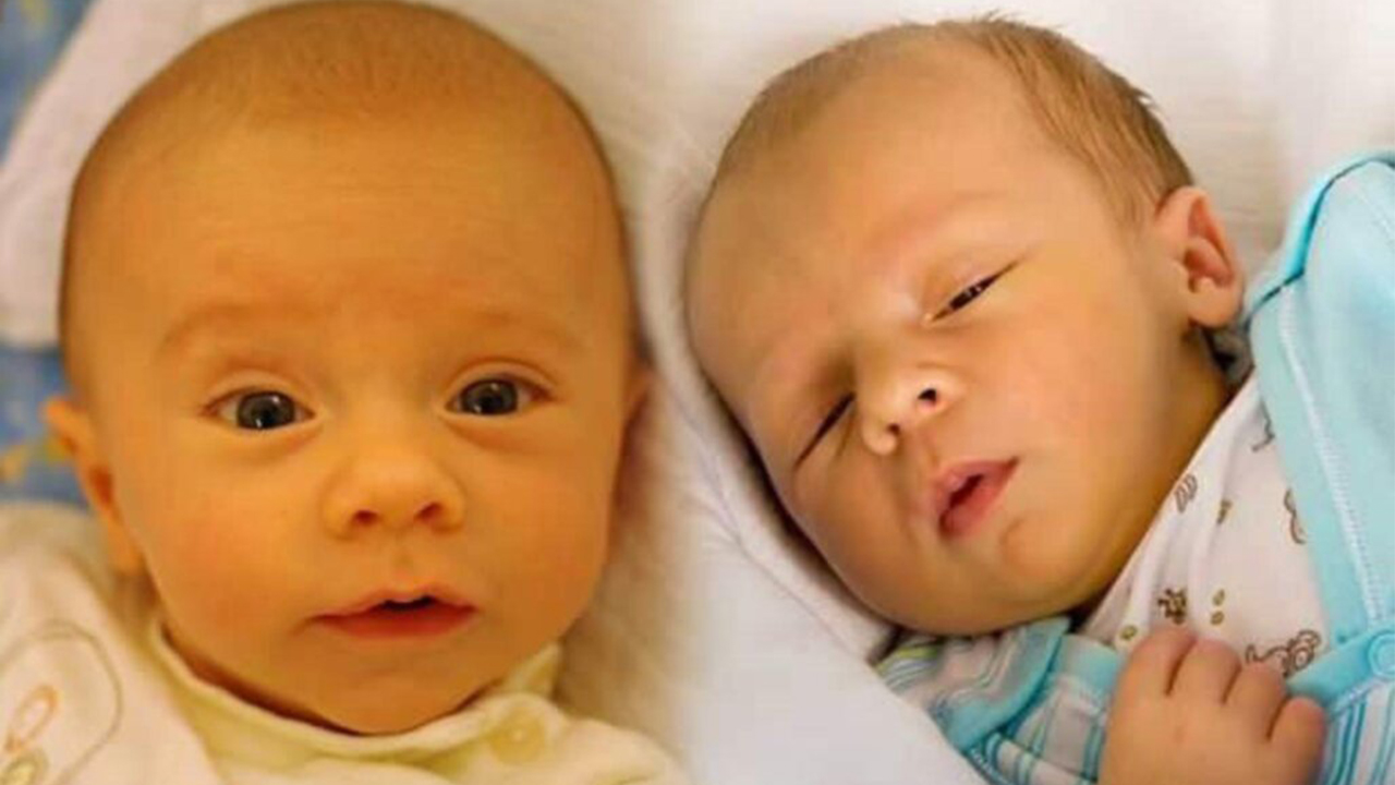 Yeni doğan Döneminde Sarılığa dikkat! 7