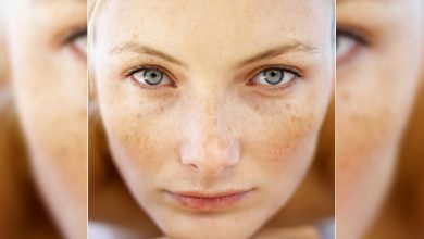 Hamilelikte oluşan cilt lekelerini dert etmeyin 1