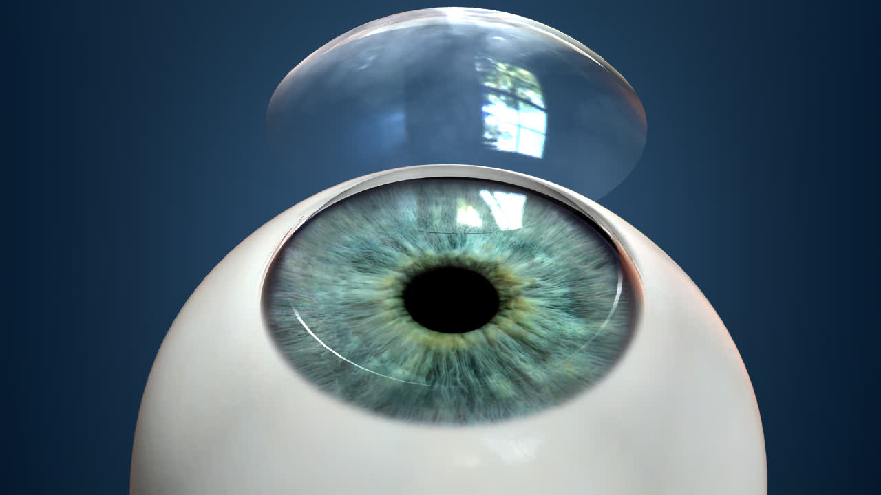 Kornea bağışı görmeyen gözlere ışık oluyor 7