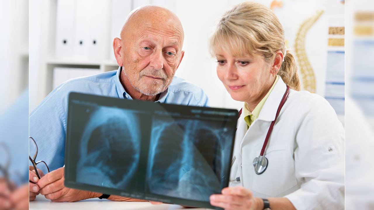 Akciğer Kanserinde en önemli risk faktörü tütün kullanımı 7