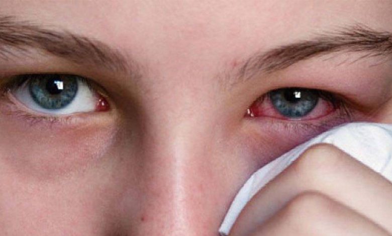 Gözlerinizi Enfeksiyonlara Karşı koruyun 1