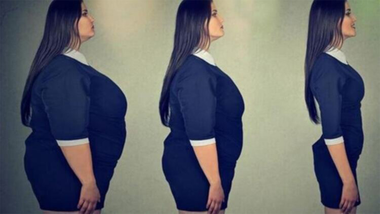 Tüp mide ameliyatı ile yeni birine dönüşmek mümkün mü? 7