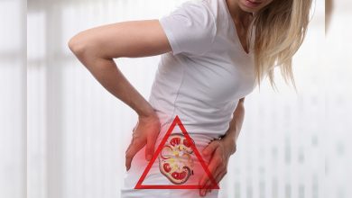 Böbrek Taşı’ Görülme Oranı Kadınlarda da artmaya başladı 1