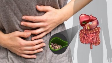 Yağlı ve dengesiz beslenme Safra kesesi taşı oluşmasına yol açıyor 7