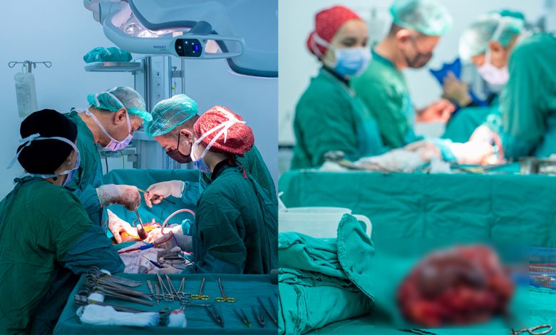 Dev tümörden türkiye’de kurtuldu! 1