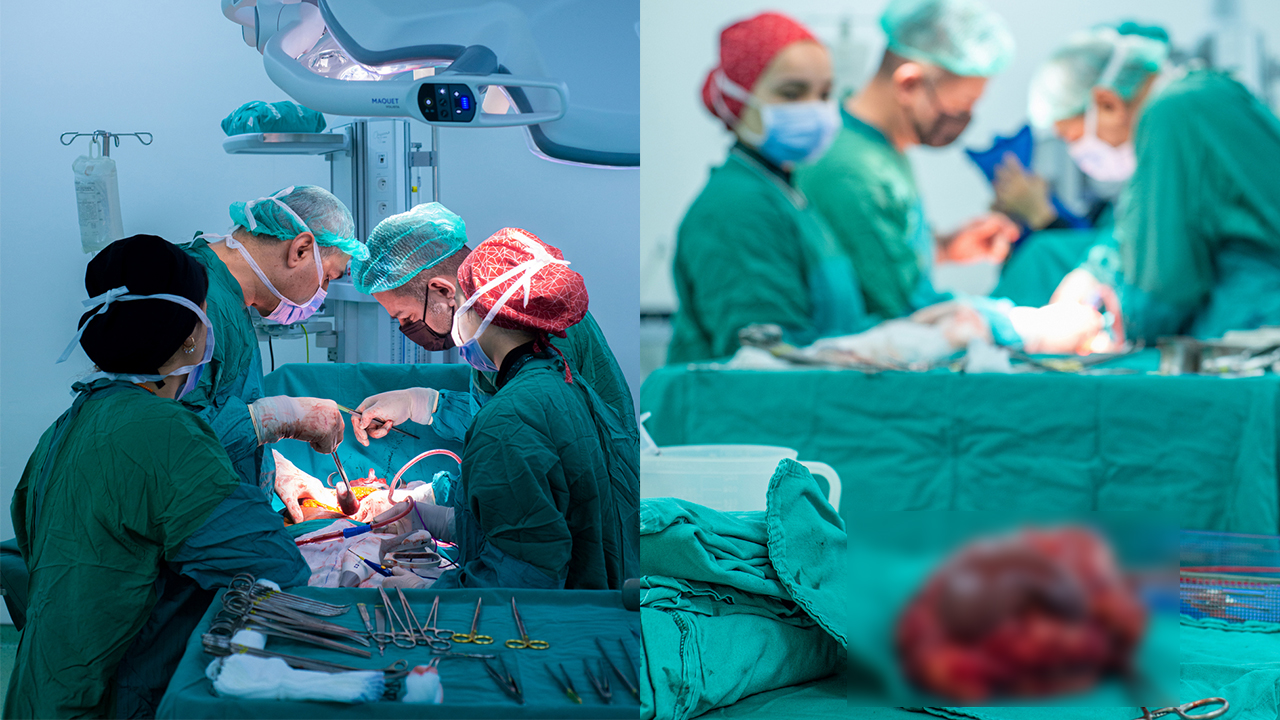 Dev tümörden türkiye’de kurtuldu! 7