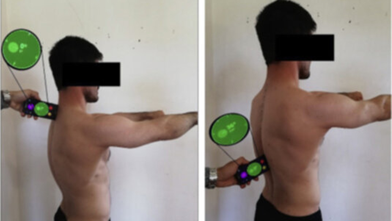 Kifoz (kamburluk) nedir? 6