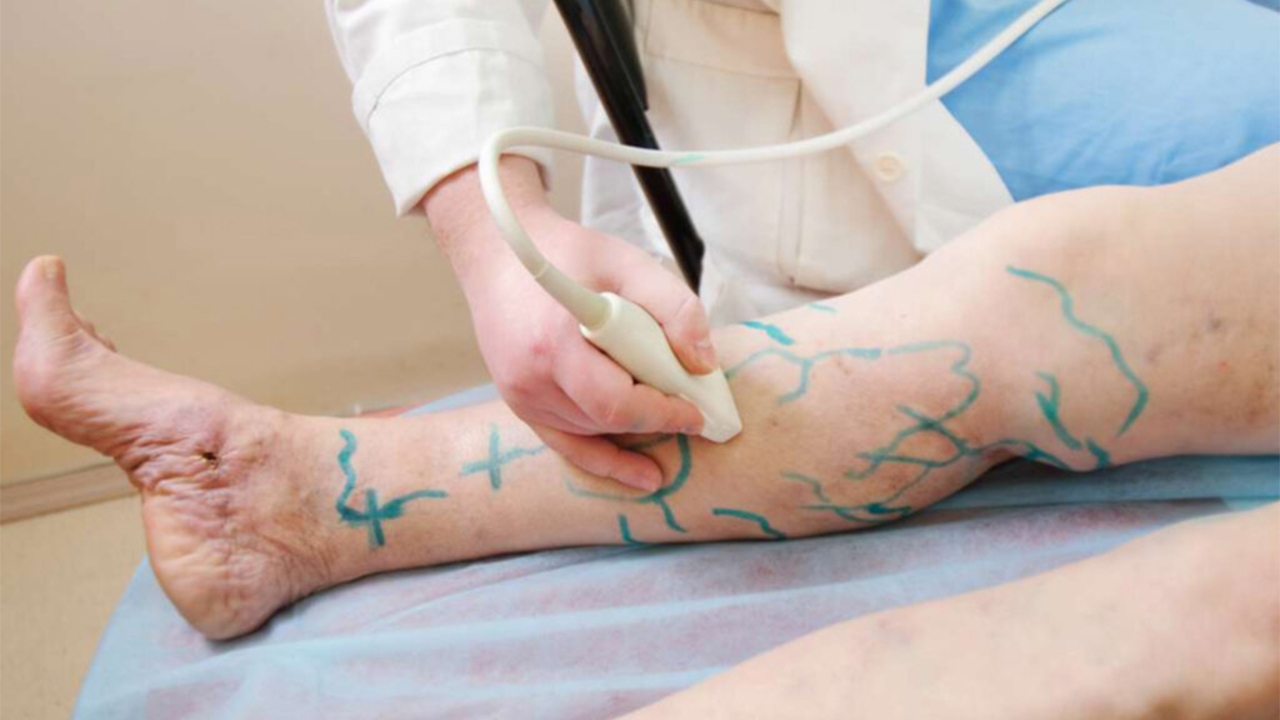 Varis, kalp kapakçıklarımız ile ilgili bizi uyarıyor! 7