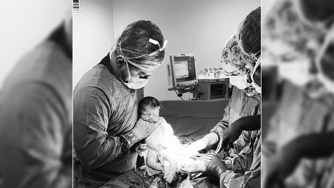 Ensesi Kalın olan her Bebek Down Sendromlu doğmaz! 7