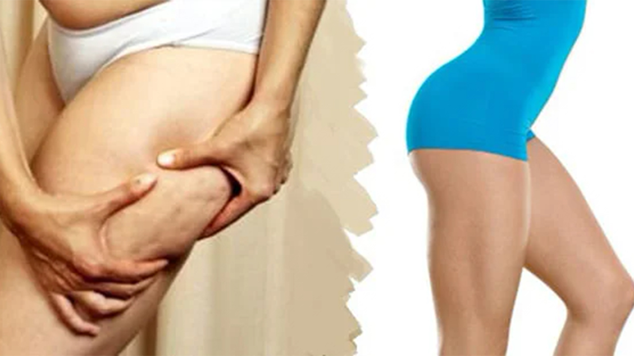 Selülitlerden kurtulmak için bunları yapın ! 7