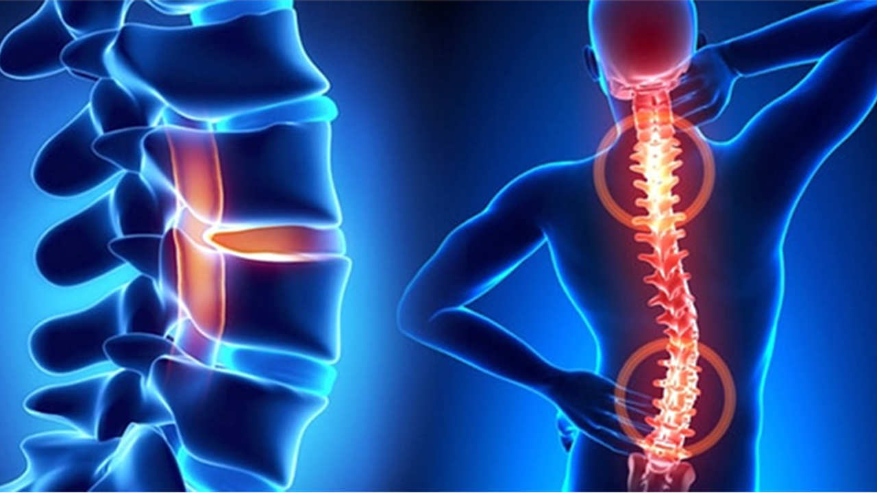 Ramazanda Omurga Sağlığını korumanın yolları 7