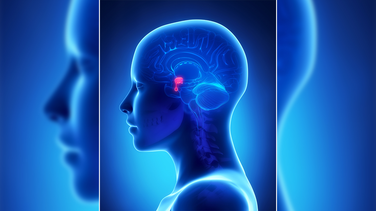 Akromegali belirtilerini fark Etmemek tanıyı geciktiriyor 7