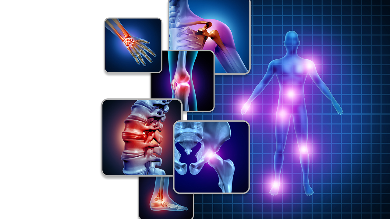 Tahlil sonuçlarında çıkmayan ağrılarınızın sebebi ‘Fibromiyalji’ olabilir? 6