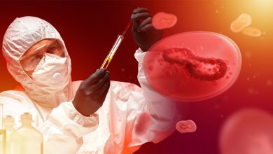 Maymun çiçeği virüsünde bu belirtilere dikkat! 20