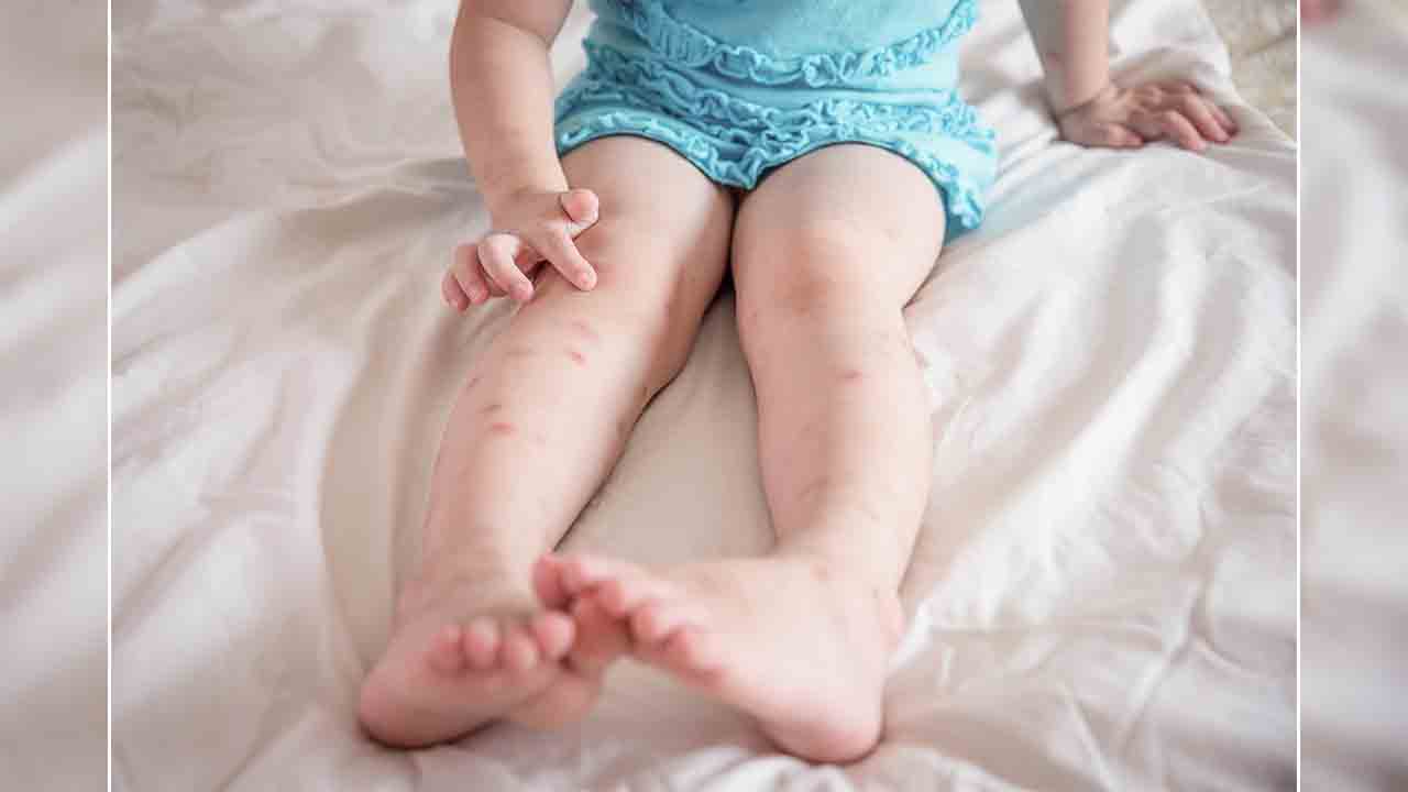 Yaz alerjilerine dikkat! 7