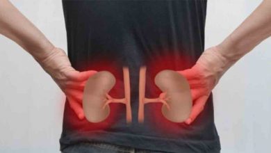 Böbrek Taşları Erkeklerde daha sık görülüyor 4