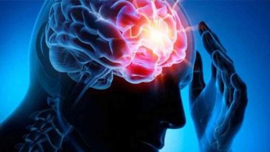 Sara atakları beyin tümörü habercisi olabilir 6