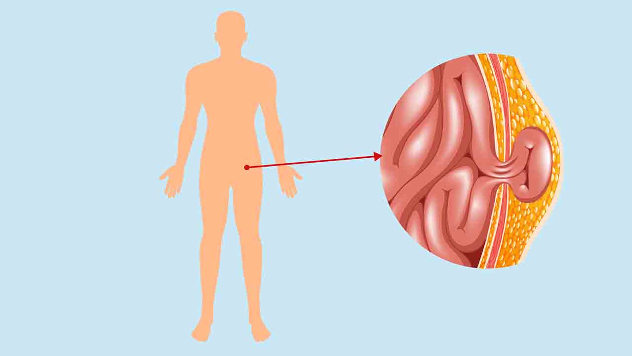 Bilinçsiz yapılan Spora dikkat edilmeli! 7