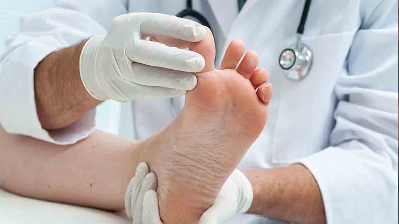 Ayak Mantarı neden olur? 6