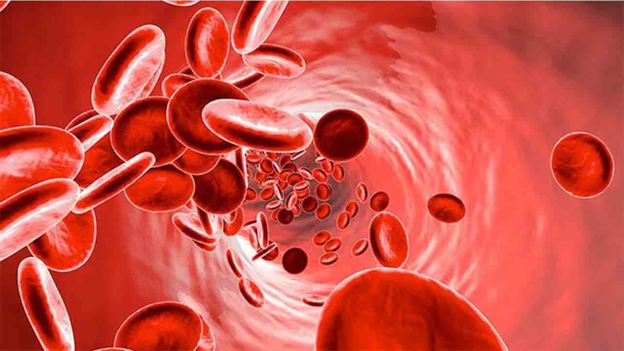 Demir Eksikliği (Anemi) kiloya neden olabiliyor ! 7