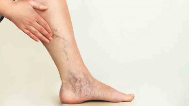 Varis sorununa dikkat! 16