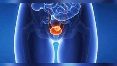 Günümüzde her 8 erkekten 1’i Prostat kanserine yakalanıyor 1