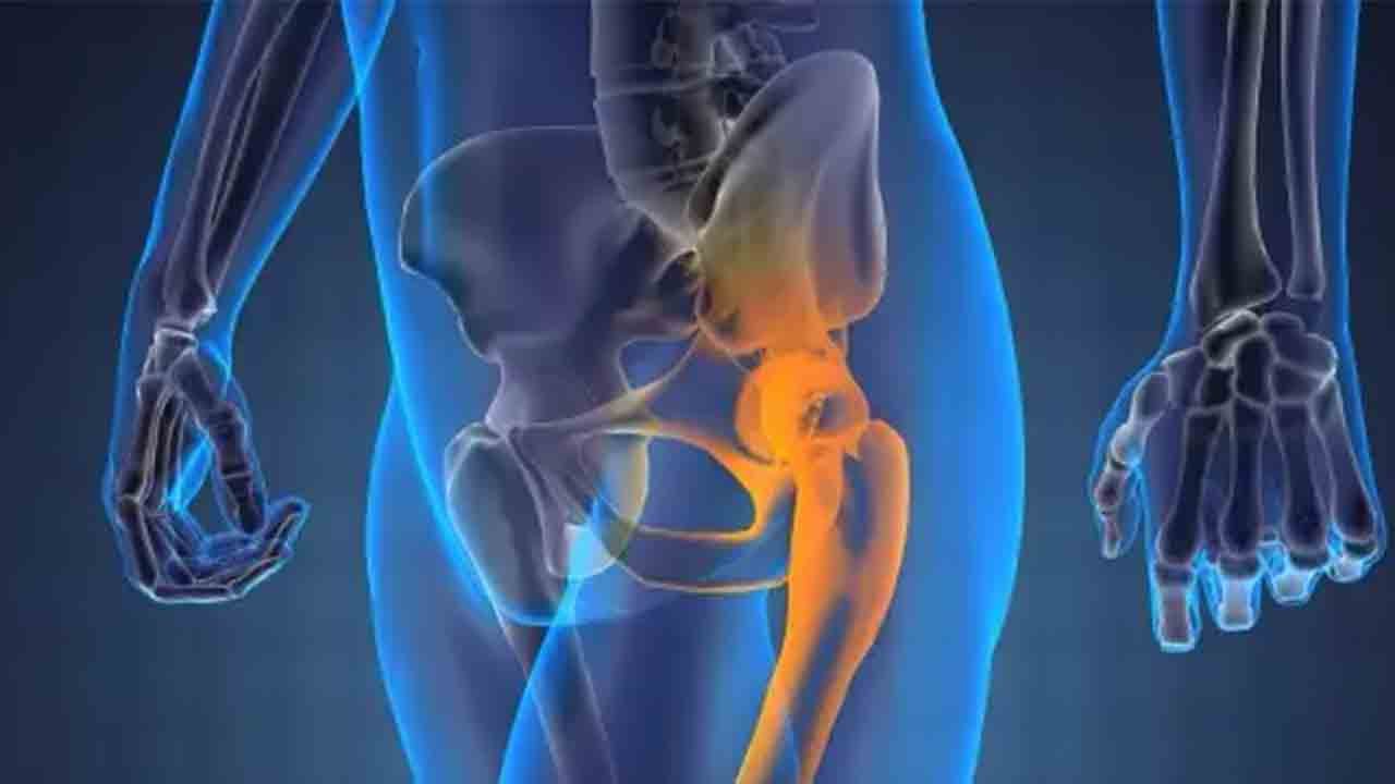 Kalça kireçlenmesine dikkat ! 6