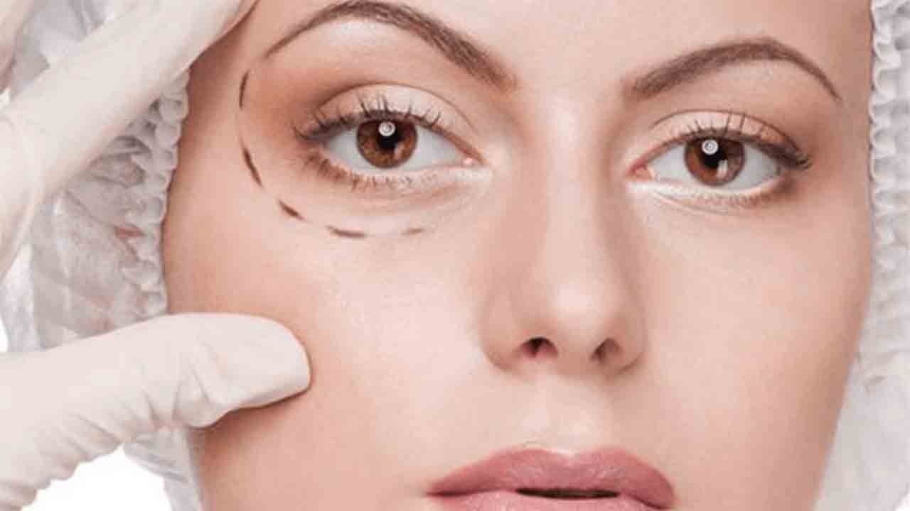 Göz kapağı sarkması tedavi edilebilir 7