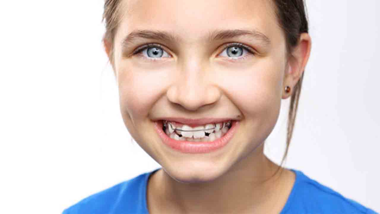 Çocuklar da Ortodontik Diş sorunlarına dikkat! 6