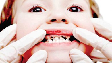 Biberon çürükleri diş yapısını bozuyor ! 4