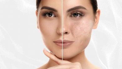 Cilt Lekelerine yol açan Faktörler nelerdir? 1