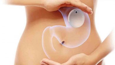 Mide balonu ile ilgili merak edilen 5 soru 9