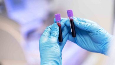 Yağ dokusundan kök hücre tedavisi ile etkili çözüm 25