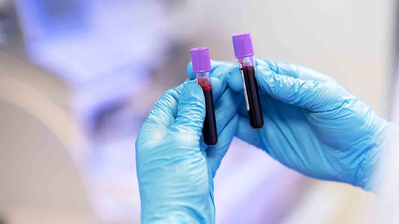 Yağ dokusundan kök hücre tedavisi ile etkili çözüm 7