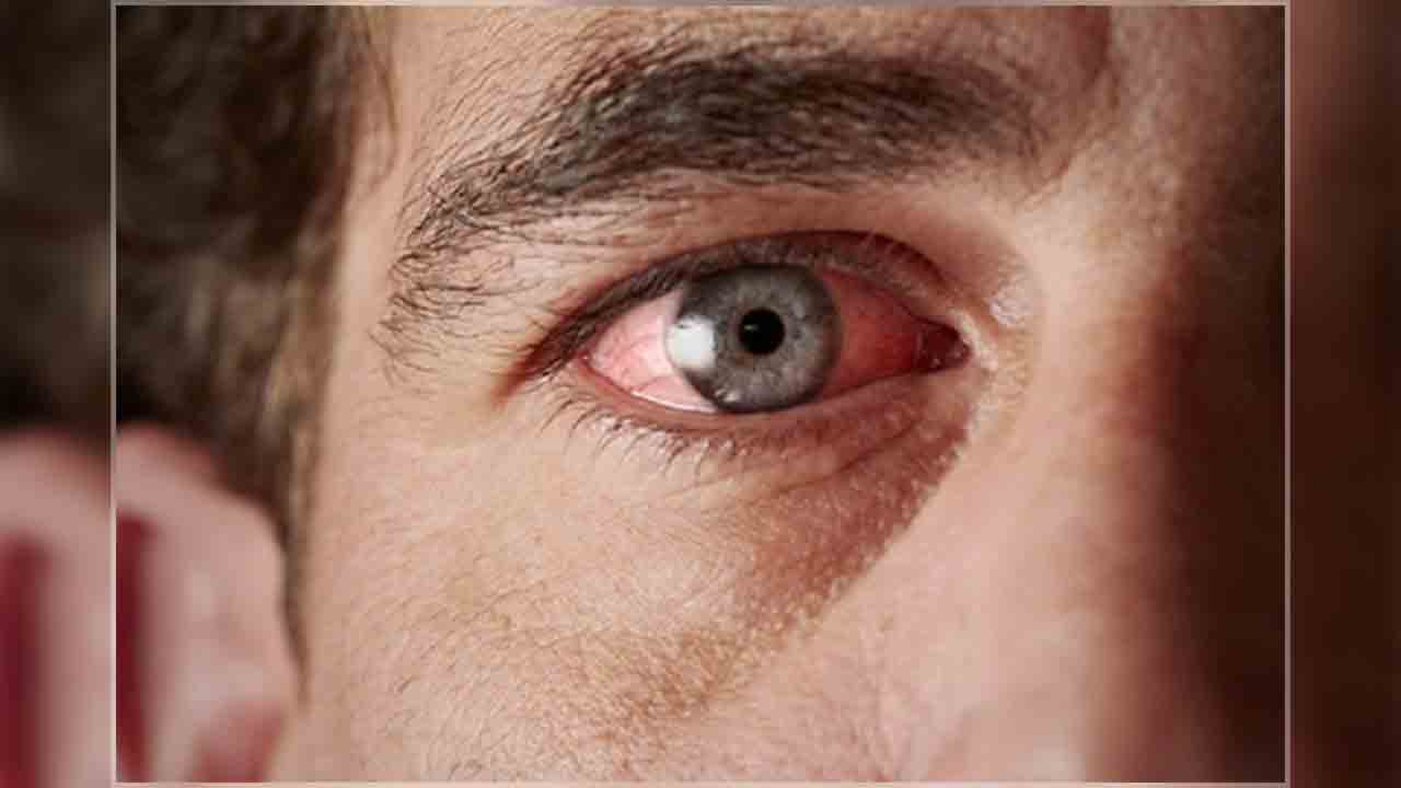 Göz Sağlığınızı Korurken Dijital Ekran Kullanımının Keyfini Çıkarın 7