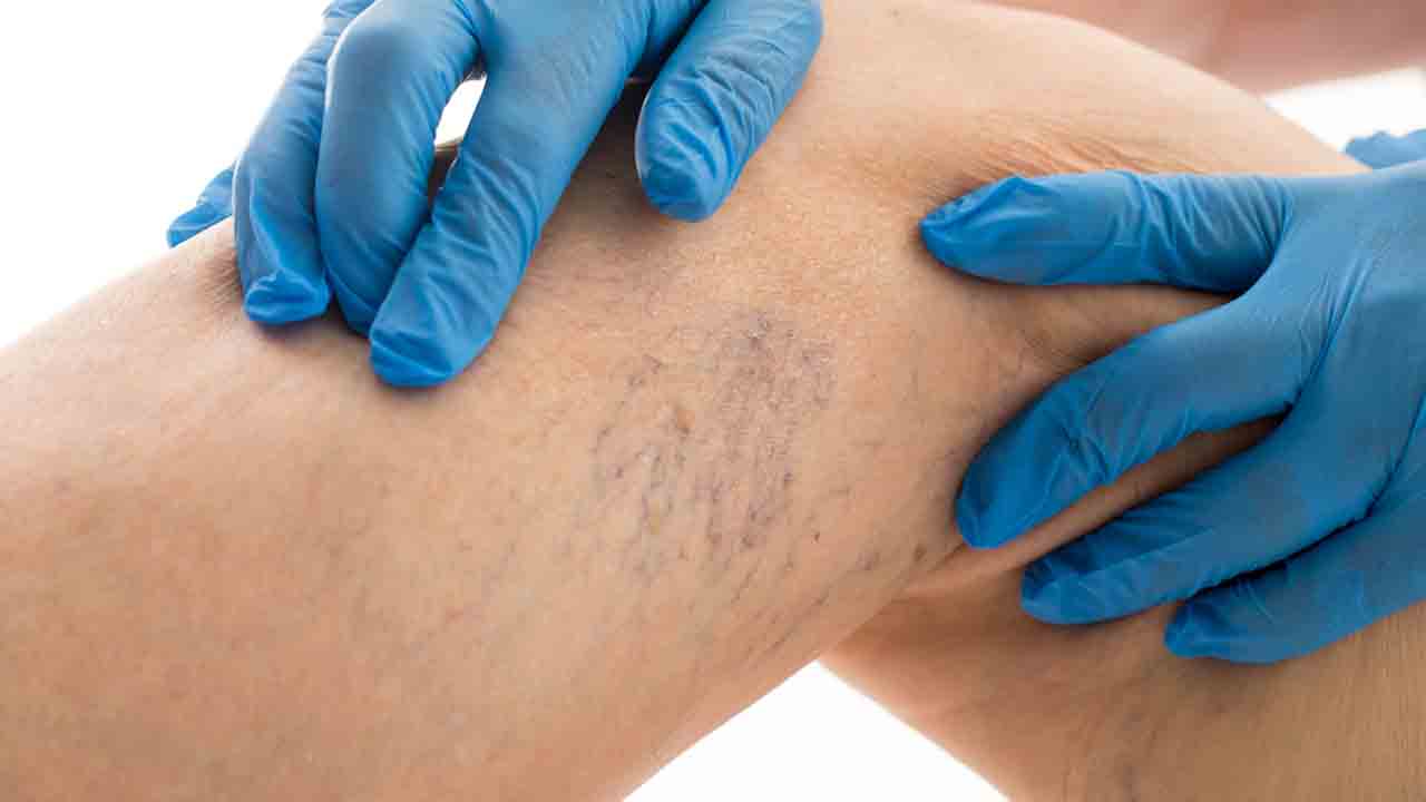 Evden çalışma, erken yaşta varis vakalarını artırdı 6