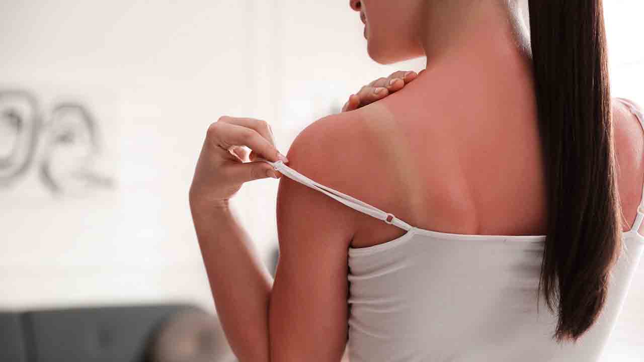 Güneş yanığına karşı 10 kritik kural! 7