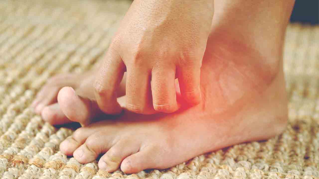 Mantar hastalığının en sık görülen belirtileri! 7