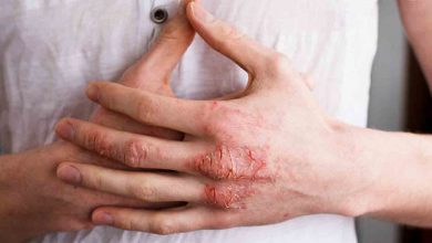 Stres egzamaya zemin hazırlıyor ! 11