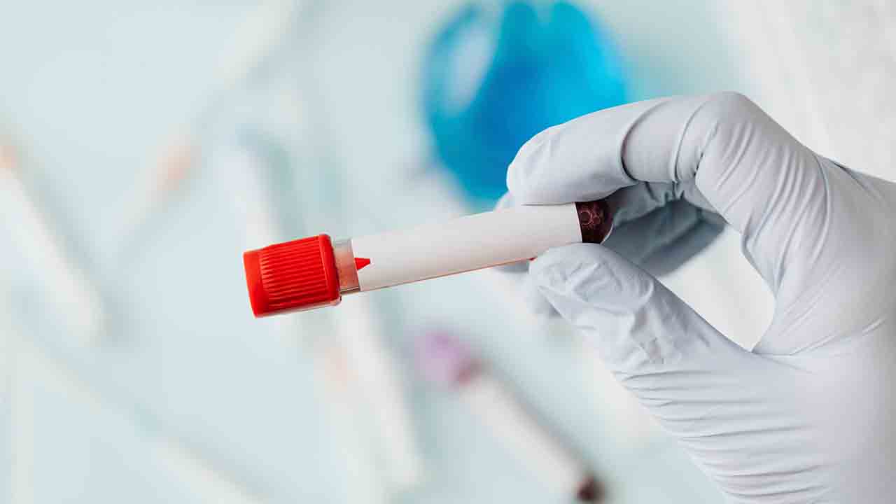 Sepsis: Vücudun sessiz fırtınası 7